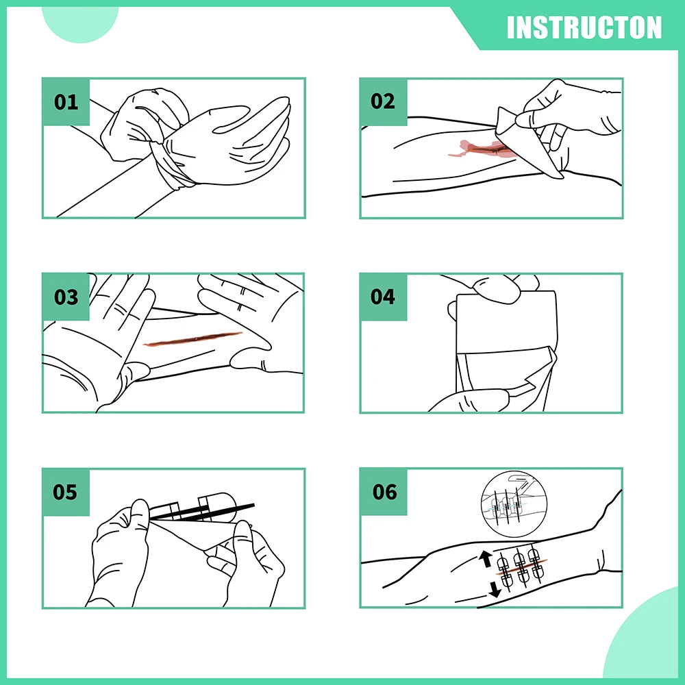 Laceration Closure Kit with Wound Dressings for Cut Care